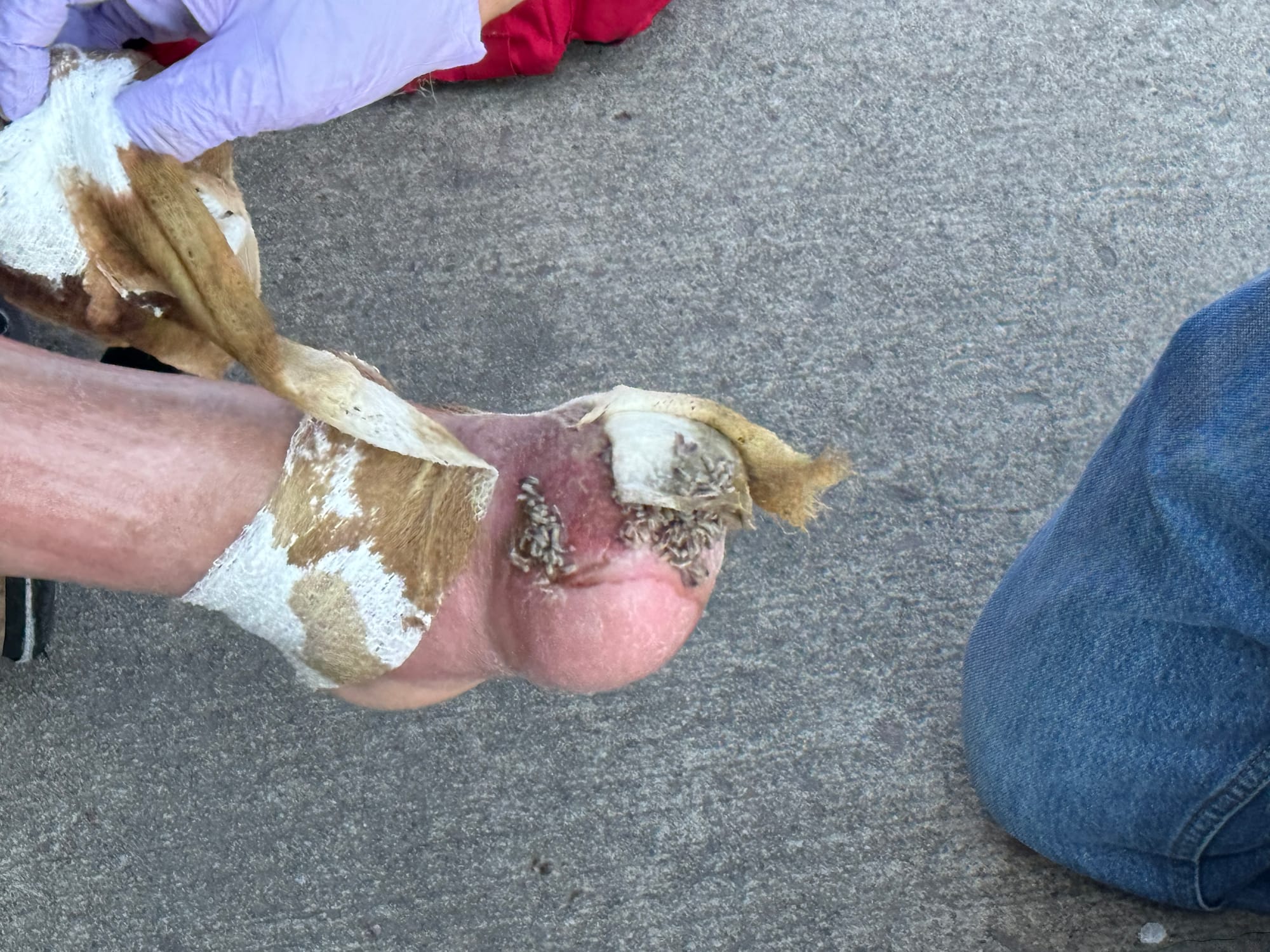 Maggots cover a foot of a man in a wheelchair as the gauze is removed.