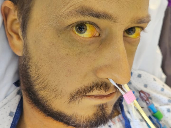 Close-up of a man in a hospital bed looking at the camera. He has tubes coming out of his nose.